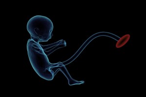 38周胎儿小两周怎么办胎儿比孕周小正常吗